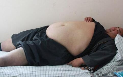 中国第一胖 肥胖如何减肥 减肥吃什么食物